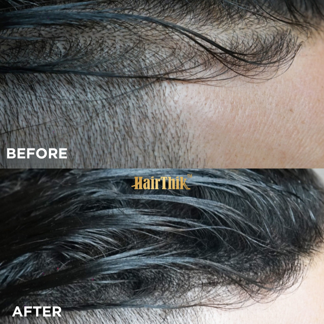 Supreme Trimmer HairThik Hair Fiber 15g