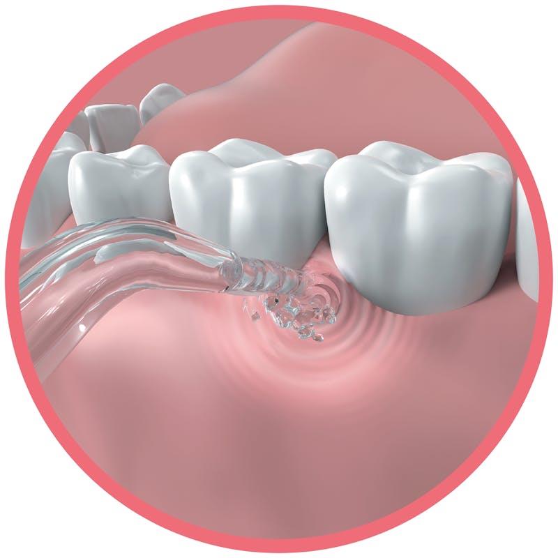 Dentagenie Water Flosser